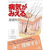 病気がみえる vol.14 皮膚科 第1版