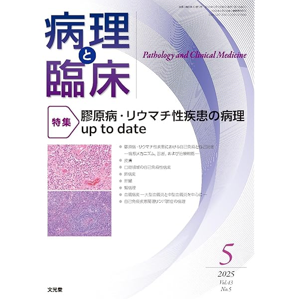 病理と臨床 2025年 2 月号 [雑誌] 【特 集】消化管Ⅱ―下部消化管