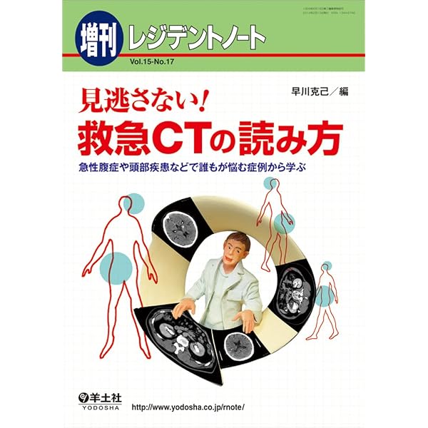 神経内科疾患の画像診断 | 柳下 章 |本 | 通販 | Amazon