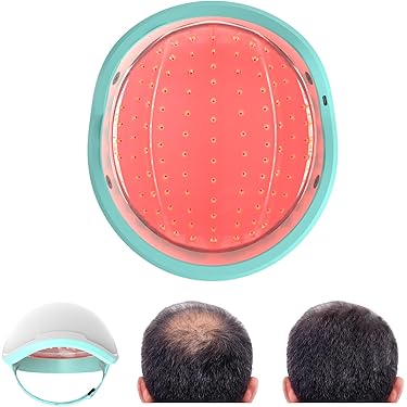 Amazon.co.jp 売れ筋ランキング: 育毛デバイス の中で最も人気の
