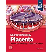 Diagnostic Pathology: Gynecological : Nucci MD, Marisa R., Oliva