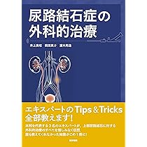 Amazon.co.jp: 尿路結石症の外科的治療 : 井上 貴昭, 岡田 真介