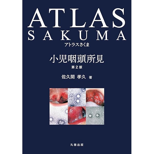 Amazon.co.jp: アトラスさくま: 小児咽頭所見 : 佐久間 孝久: 本