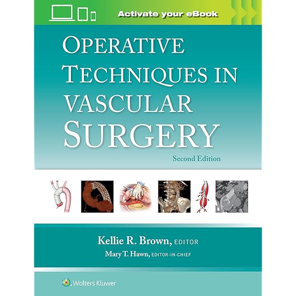 Amazon | Anatomic Exposures in Vascular Surgery | Valentine