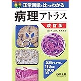 正常画像と比べてわかる 病理アトラス　改訂版〜全身がみえてくる！ 118疾患1000画像