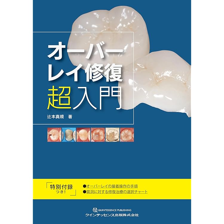 Vital Pulp Therapy 深在性う蝕に対する治療法 深在性う蝕に対するVital Pulp Therapy - クインテッセンス出版