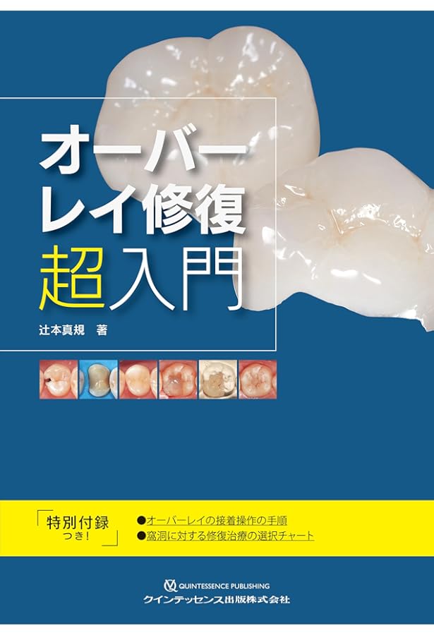 接着ブリッジ臨床ガイド 大谷一紀 1リテーナーオールセラミック 接着ブリッジ臨床ガイド | 大谷