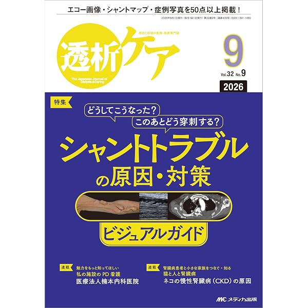 エコーでできる評価と管理 バスキュラーアクセス超音波50症例 | 小林