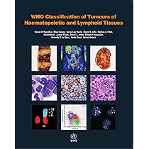 WHO classification of tumours of haematopoietic and lymphoid