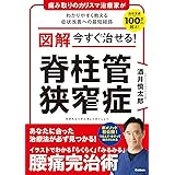 図解 今すぐ治せる! 脊柱管狭窄症