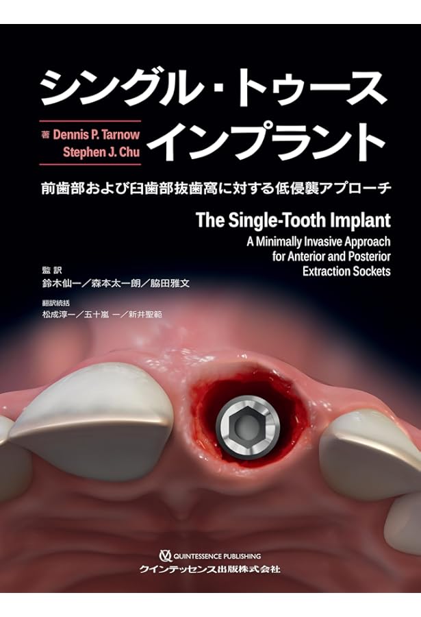 即時治療の真髄: 補綴的要件を達成するための即時埋入と即時負荷