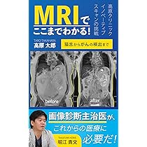 ポケット版 MRI準備体操?上手につきあうための第一歩 高原 太郎 楽天ブックス: MRI準備体操ポケット版 - 上手につきあうための第