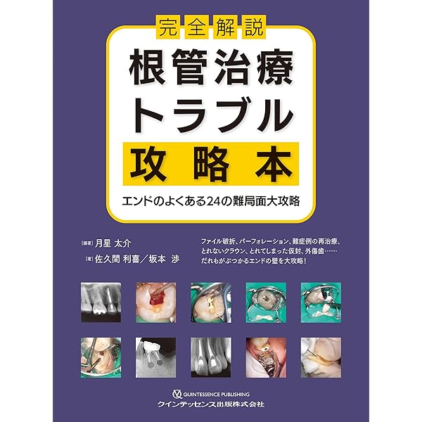【裁断済み】インプラント補綴マニュアル　パーツで困ったときの取扱説明書 インプラント補綴マニュアル: パーツで困ったときの取扱説明書