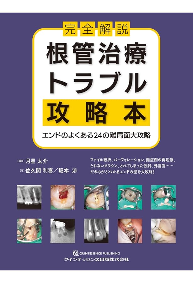 Amazon.co.jp: 低侵襲・低コスト・省時間を実現する バシロジック