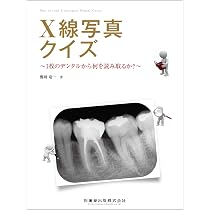 パノラマ診断 パーフェクトガイド: チェアサイドですぐ役立つ! 撮影 