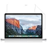LOE(ロエ) ノートパソコン 保護フィルム for 旧 MacBook Pro 15 (2015) 反射防止 ギラついたり文字がにじんだりしない スーパーAG アンチグレア 日本製