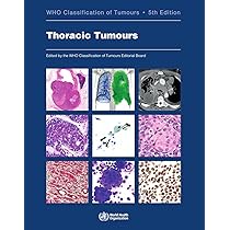 WHO Classification of Tumours of Haematopoietic and Lymphoid Tissues (World Health Organization Classification of Tumours) [ペーパーバック] Swerdlow， Steven H.、 Campo， Elias、 Harris， Nancy Lee、 Jaffe， Elaine 41elpwdtDPL._UF1000,1000_QL80_.jpg