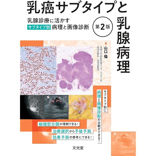 乳癌 第3版(腫瘍病理鑑別診断アトラス) | 森谷卓也, 津田 均, 腫瘍病理