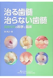 深在性う蝕に対するVital Pulp Therapy: 歯髄保存か抜髄かは患者のため