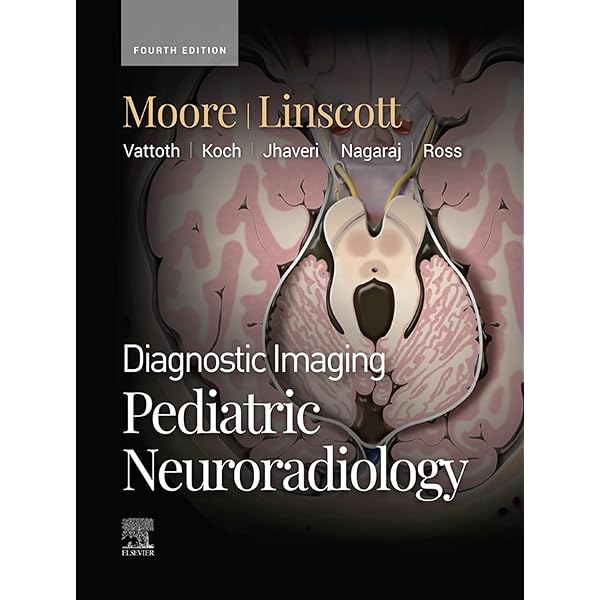 Amazon.co.jp: Volpe's Neurology of the Newborn E-Book (English