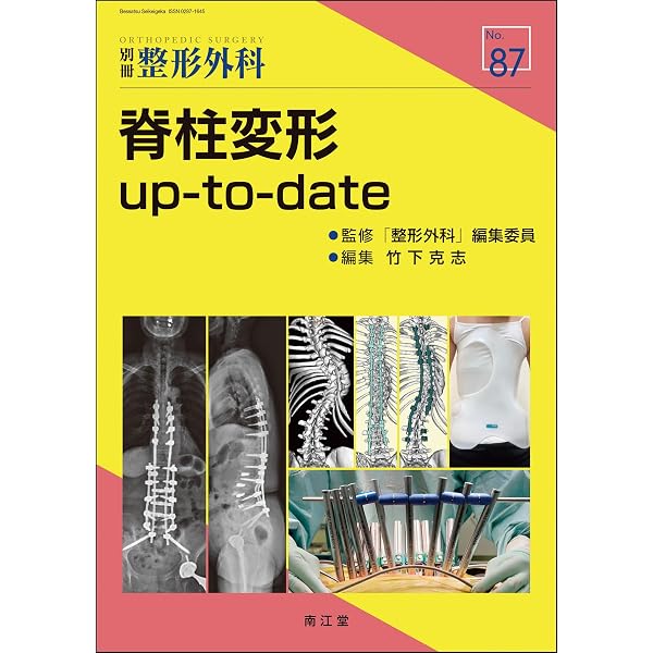 Amazon.co.jp: 小児脊柱変形治療の最前線 : 日本側彎症学会: 本