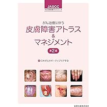 Amazon.co.jp: がん患者の皮膚障害アトラス : 宇原 久: 本