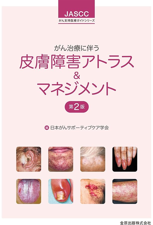 Amazon.co.jp: がん患者の皮膚障害アトラス : 宇原 久: 本