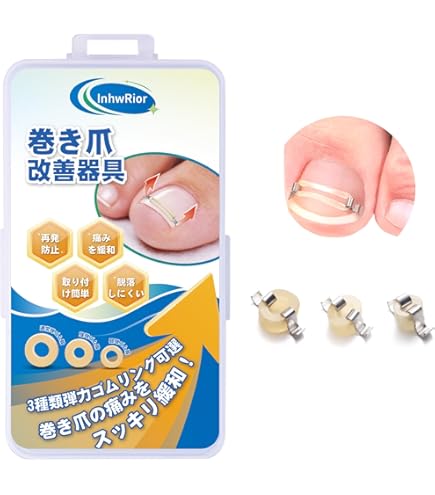 Amazon | NEW まきづめリフト 巻き爪矯正 1個 (x 1) | まきづめリフト