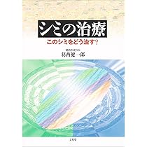 シミの治療 |本 | 通販 | Amazon