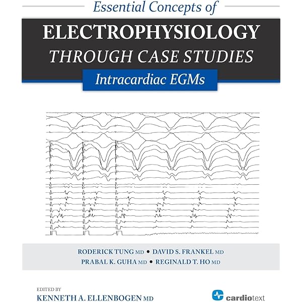 Case Studies in Clinical Cardiac Electrophysiology [ハードカバー] Miller MD，John M.、 Das MD，Mithilesh K.; Zipes MD，Douglas P. Amazon | Case Studies in Clinical Cardiac Electrophysiology