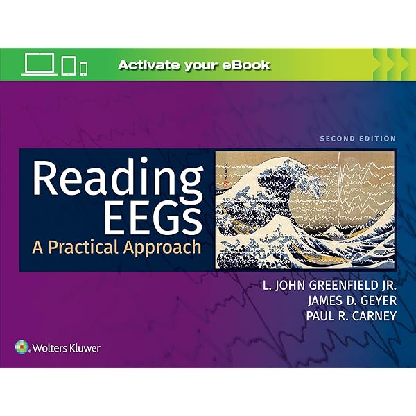 Amazon | Epilepsy: A Comprehensive Textbook | Engel Jr