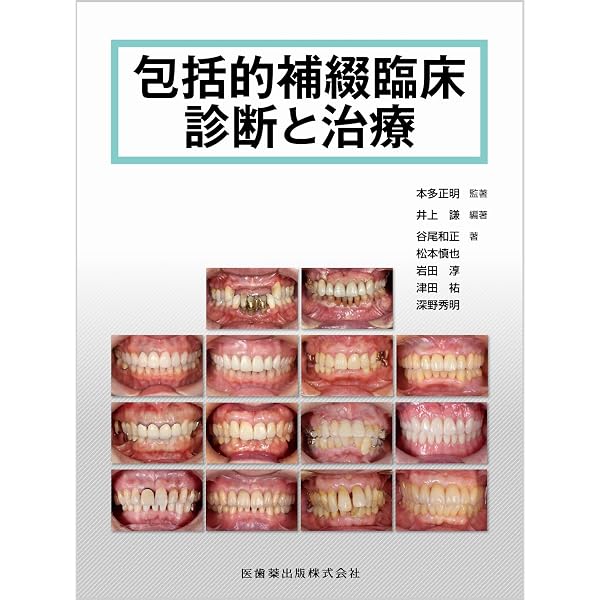 パノラマ診断 パーフェクトガイド: チェアサイドですぐ役立つ! 撮影