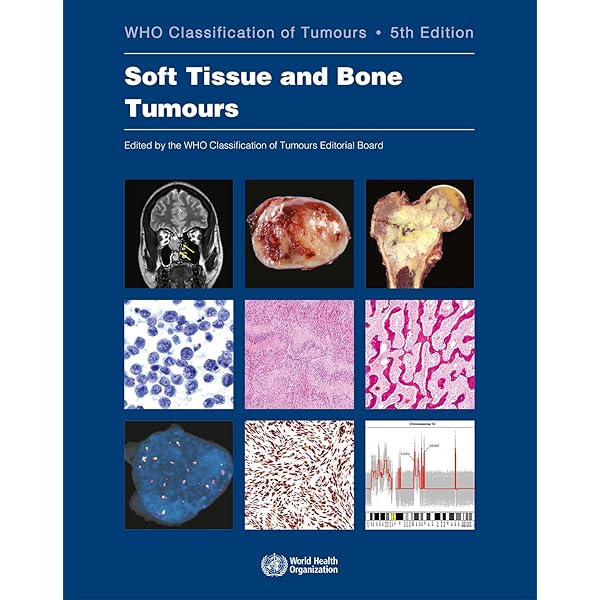 語学+参考書 Female Genital Tumours: Who Classification of Tumours (Who Classification of Tumours 4) WHO Classification of Tumours of the Female Reproductive