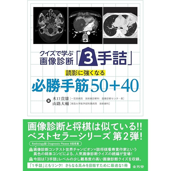 エビデンスからせまる肝のMRI エビデンスからせまる肝のMRI 1. 診断のポイント | 画像診断情報
