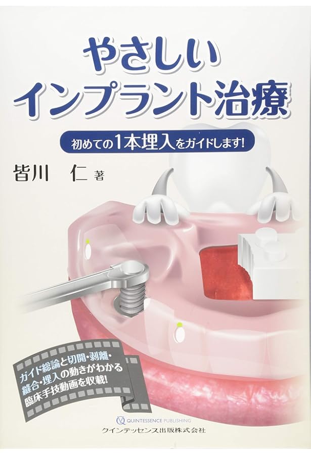 Amazon.co.jp: 新版 1からはじめるインプラント治療 完全マニュアル