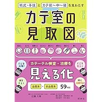 カテ室の見取図: 術式・手技とカテ前~中~後を見わたす | 近藤大稀
