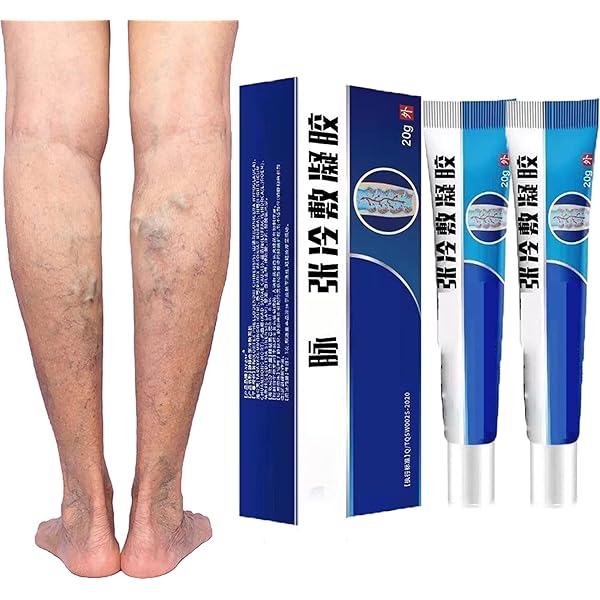 Amazon.co.jp: 静脈瘤、クモの脚 : ビューティー