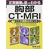 正常画像と並べてわかる胸部CT・MRI―ここが読影のポイント