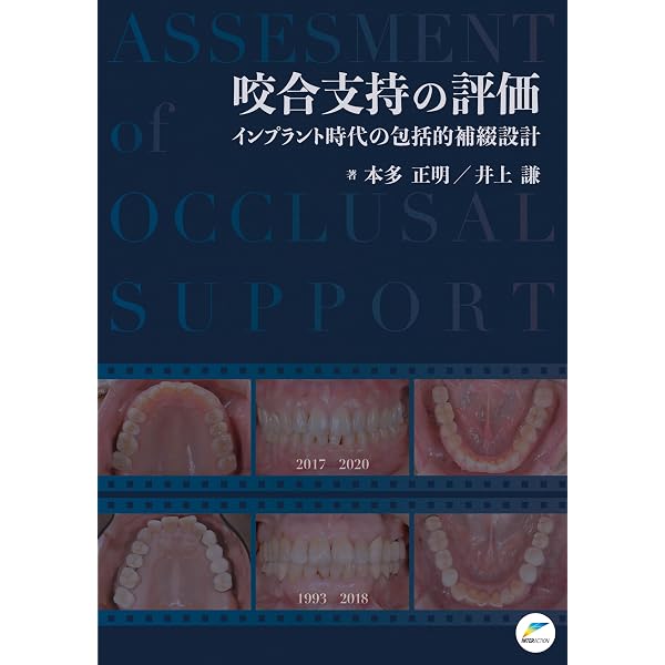 RESTORATIVE DESIGN & PRACTICAL OCCLUSION 実践的咬合 | 本多 正明