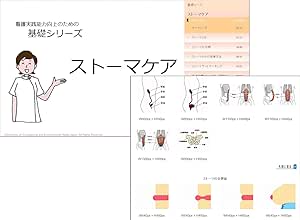 Amazon ストーマケアｅラーニングコース 教師 研修指導者版 能力開発 Pcソフト