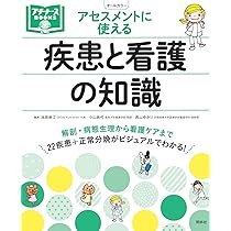 71qZORJh4GL._AC_UL210_SR210,