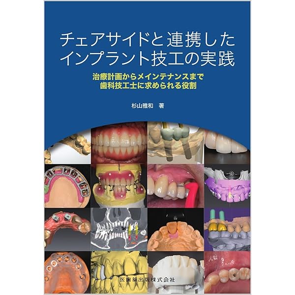 歯科技工別冊 インプラント技工のメインストリーム | 関根 秀志, 萩原
