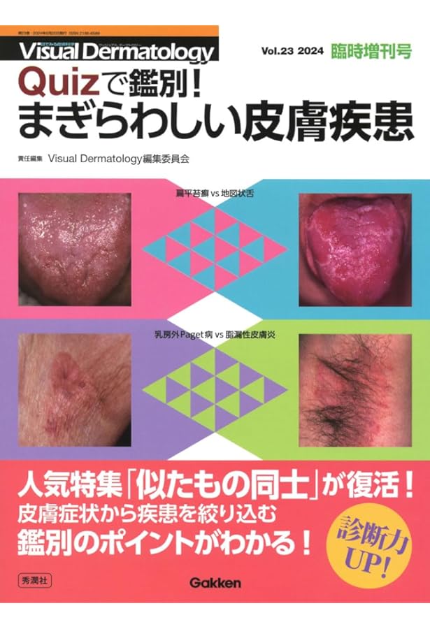 Amazon.co.jp: 好発部位でみる皮膚疾患アトラス 頭部・顔: 頭頚部