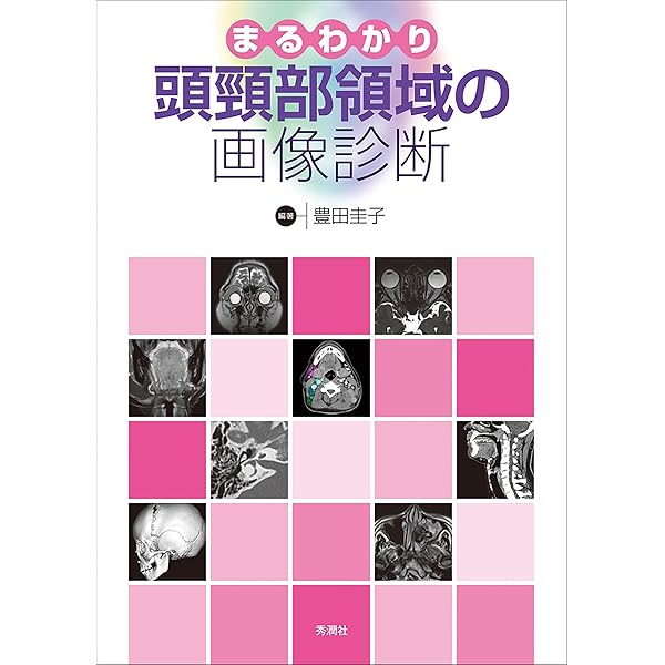 頭頸部画像診断に必要不可欠な臨床・画像解剖 | 尾尻博也, 尾尻