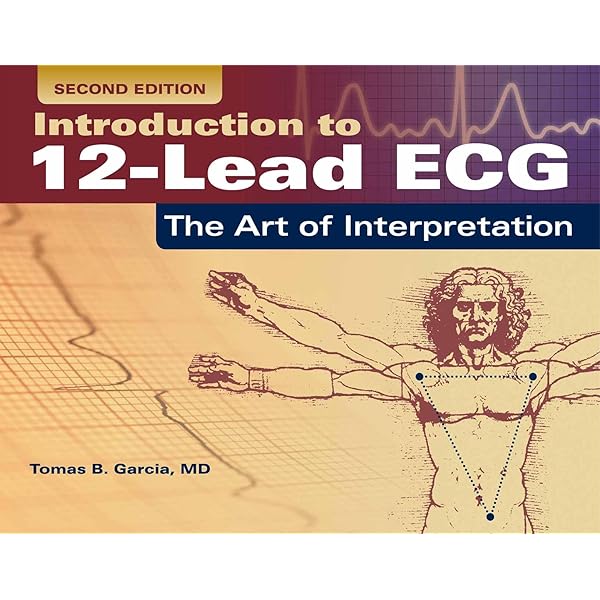 Amazon | Chou's Electrocardiography in Clinical Practice: Adult