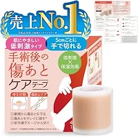Amazon.co.jp: エキスパートこだわりの帝王切開術：理論＋根拠を押さえ