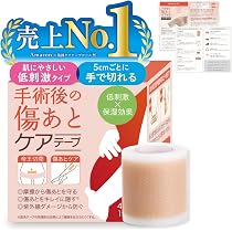 Amazon.co.jp: skinix アトレスケア 傷あとケア専用テープ 50×50mm 30