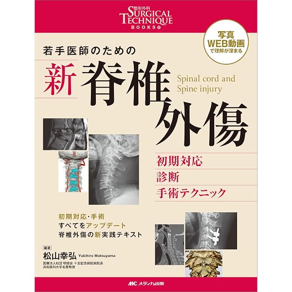 改訂第2版 骨折 髄内固定治療マイスター | 澤口 毅 |本 | 通販 | Amazon