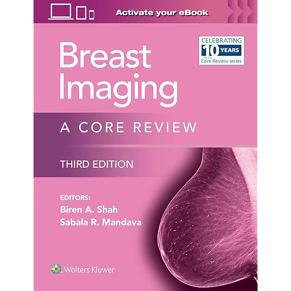 Amazon | Breast Imaging | Kopans MD, Daniel B. | Diagnostic Imaging