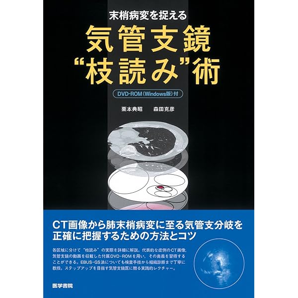Amazon.co.jp: 気管支鏡所見【電子版付】〜見方・読み方・考え方